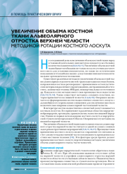 Увеличение объема костной ткани альвеолярного отростка верхней челюсти методикой ротации костного лоскута