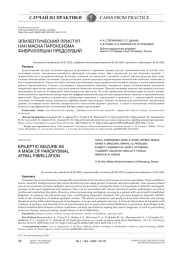 ЭПИЛЕПТИЧЕСКИЙ ПРИСТУП КАК МАСКА ПАРОКСИЗМА ФИБРИЛЛЯЦИИ ПРЕДСЕРДИЙ