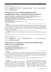 Клинический случай лечения артериовенозной мальформации стопы у пациентки молодого возраста